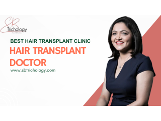 good-hair-transplant-doctor-in-gurgaon-small-0