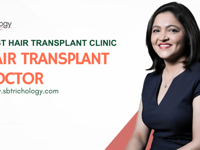 good-hair-transplant-doctor-in-gurgaon