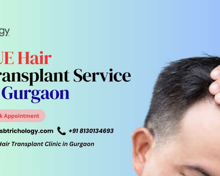 fue-hair-transplant-service-in-gurgaon