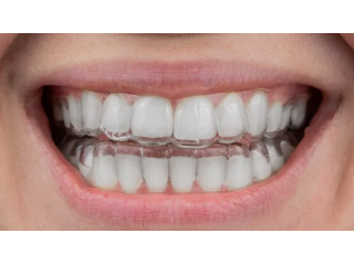 invisible-clear-teeth-aligners-for-effortless-alignment-small-0