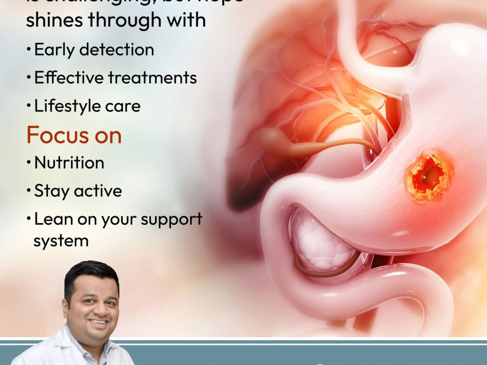 early-detection-saves-lives-stomach-cancer-treatment-in-ahmedabad-big-0