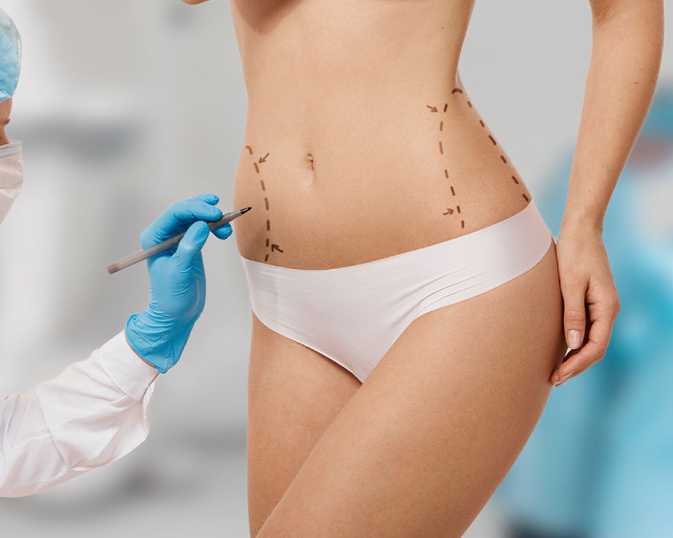 perfect-your-shape-with-liposuction-in-delhi