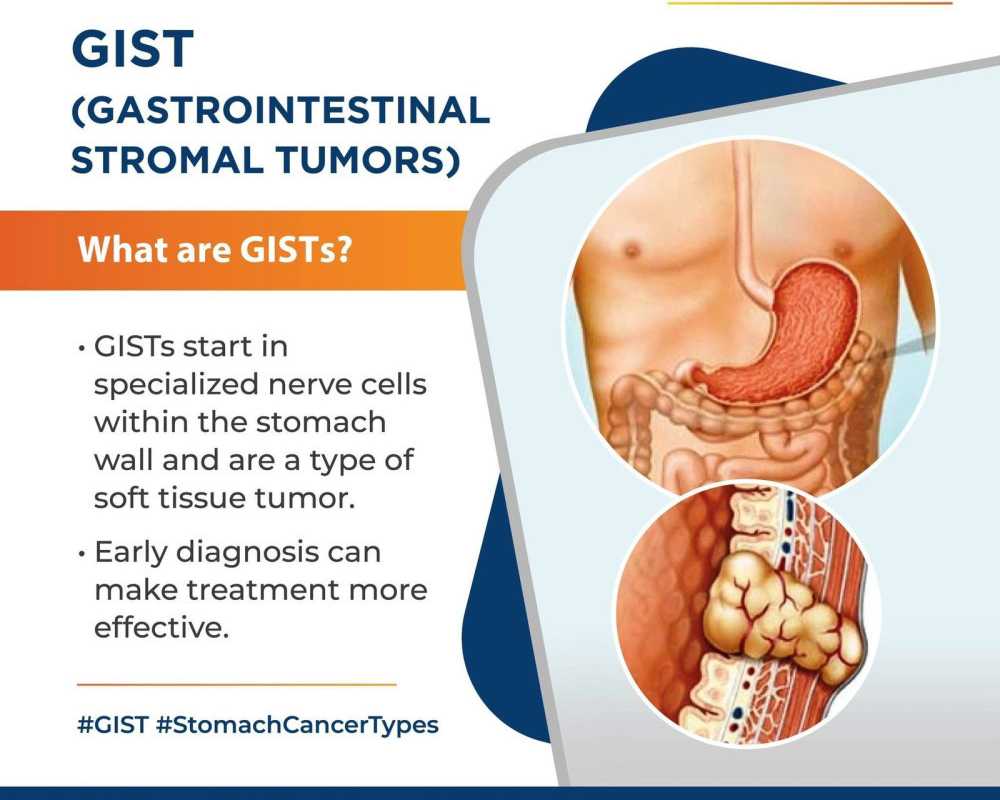 personalised-stomach-cancer-treatment-in-ahmedabad-by-dr-viraj-lavingia