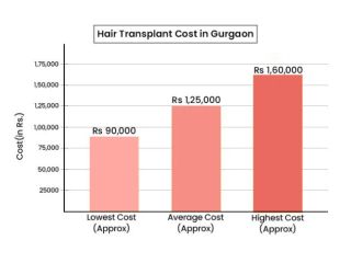 choose-sb-trichology-for-the-hair-transplant-journey-small-0