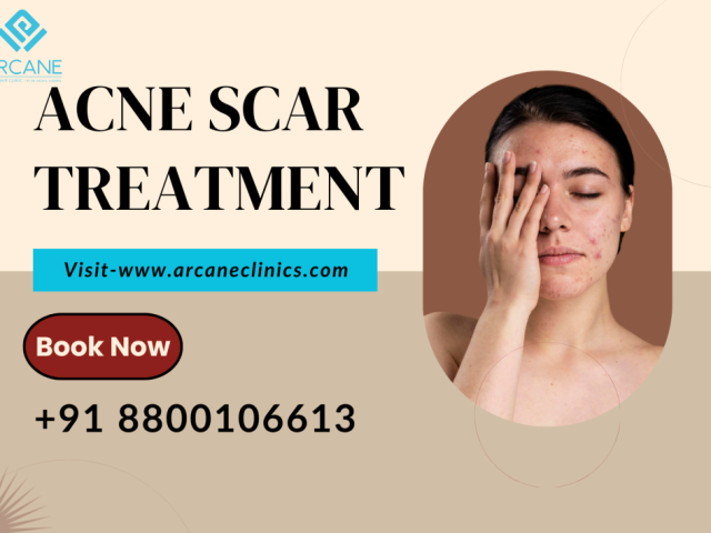 get-advanced-acne-scar-treatment-in-noida