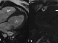 precise-heart-mri-services-for-accurate-cardiac-care-picture-this-imaging
