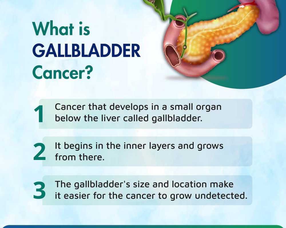 top-hospital-for-gallbladder-cancer-treatment-in-ahmedabad