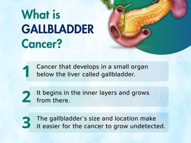 top-hospital-for-gallbladder-cancer-treatment-in-ahmedabad