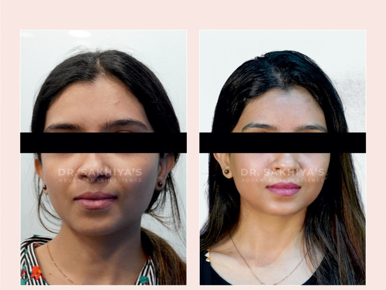 best-cream-for-glowing-skin-your-guide-to-brighter-healthier-skin-big-4