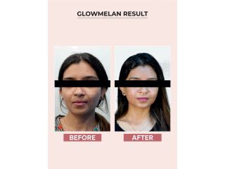 best-cream-for-glowing-skin-your-guide-to-brighter-healthier-skin-small-4