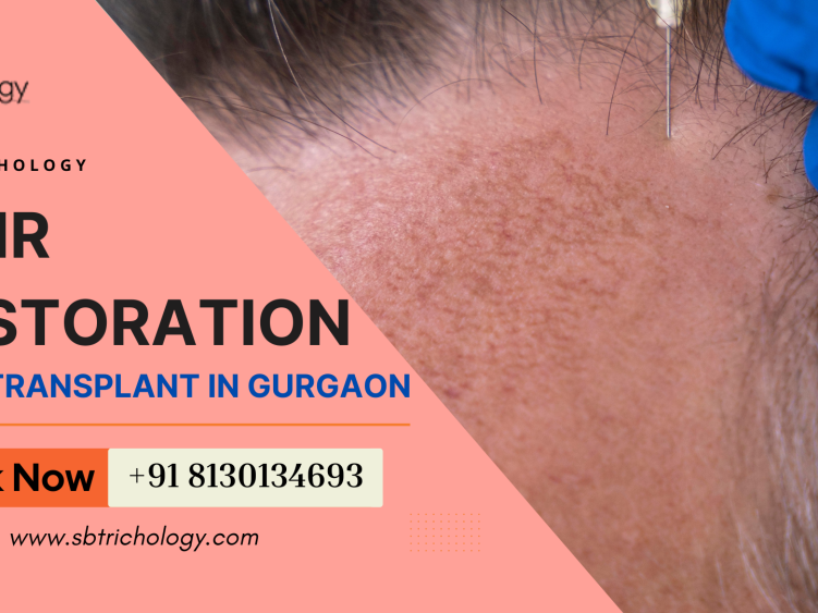 choose-wisely-before-your-hair-restoration-journey-big-0