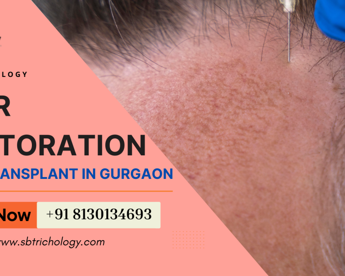 choose-wisely-before-your-hair-restoration-journey