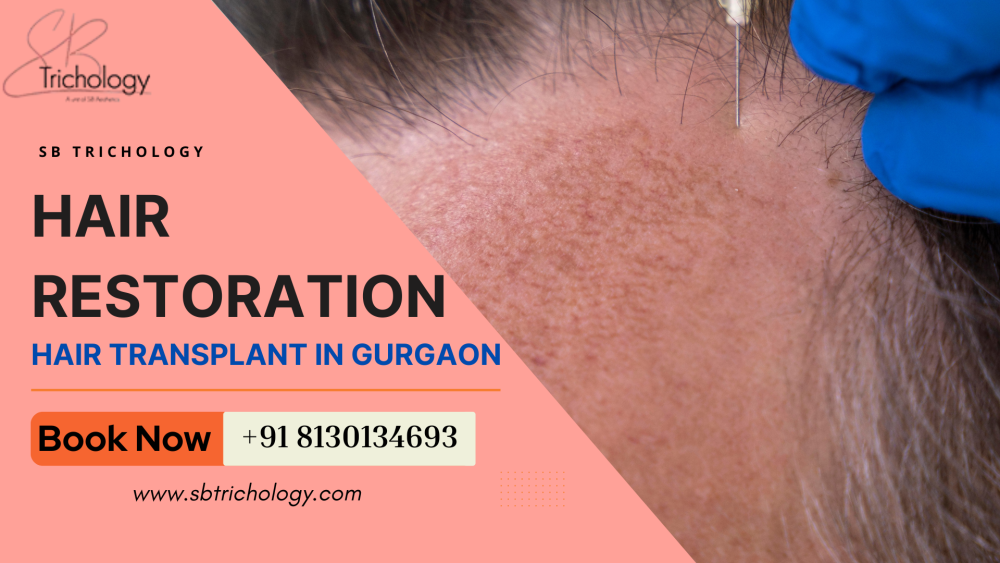 choose-wisely-before-your-hair-restoration-journey-big-0