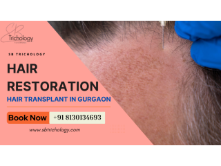 choose-wisely-before-your-hair-restoration-journey-small-0