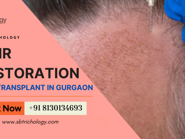 choose-wisely-before-your-hair-restoration-journey