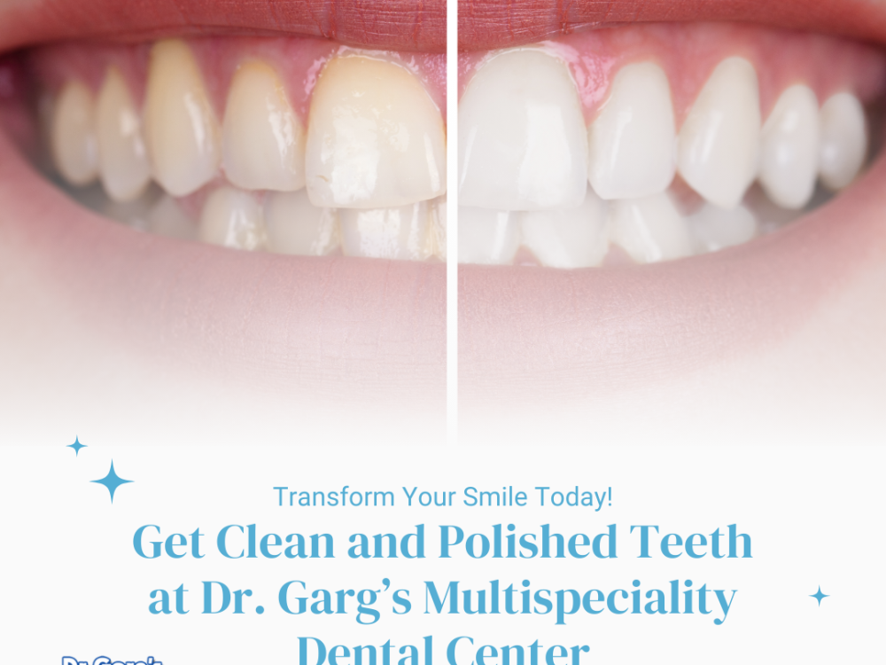 get-clean-and-polished-teeth-at-dr-gargs-multispeciality-dental-center-big-0