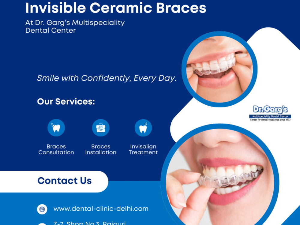 straighten-your-smile-with-invisible-ceramic-braces-at-dr-gargs-multispeciality-dental-center-big-0