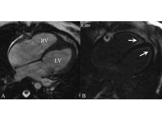 high-resolution-mri-scan-in-mumbai-for-accurate-diagnosis-picture-this-imaging-small-0