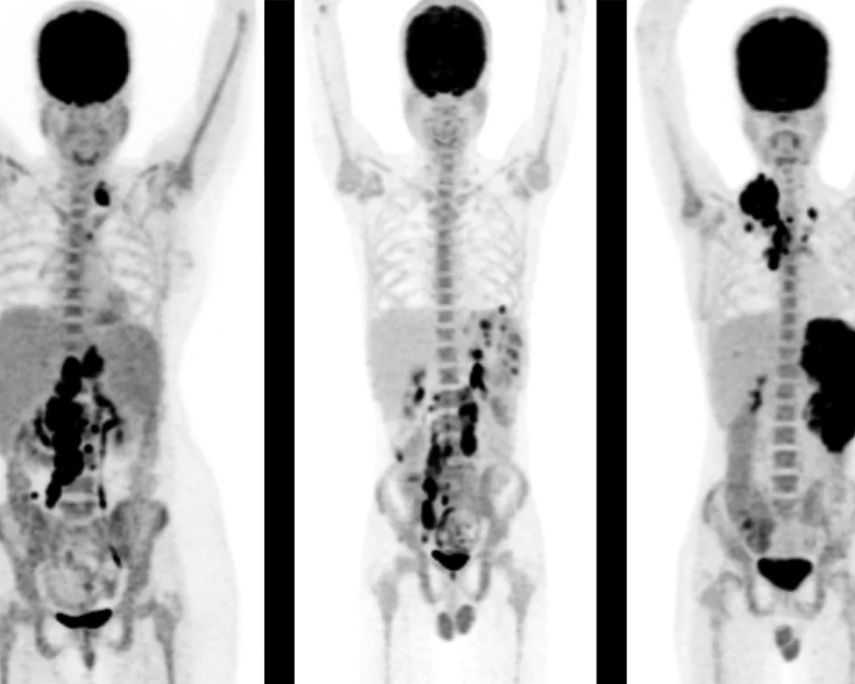 affordable-pet-scan-cost-in-mumbai-with-precision-imaging-picture-this-imaging