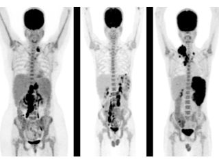 affordable-pet-scan-cost-in-mumbai-with-precision-imaging-picture-this-imaging-small-0
