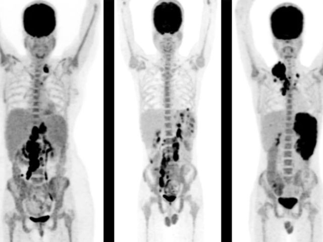 affordable-pet-scan-cost-in-mumbai-with-precision-imaging-picture-this-imaging