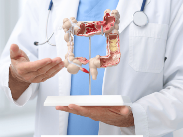 get-treatment-from-the-best-gastrointestinal-surgeon-in-mumbai