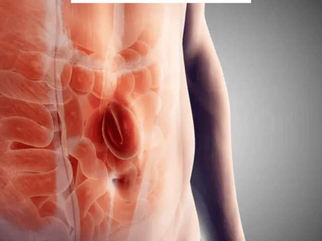 best-hernia-surgeon-in-mumbai-india-for-safe-advanced-treatment