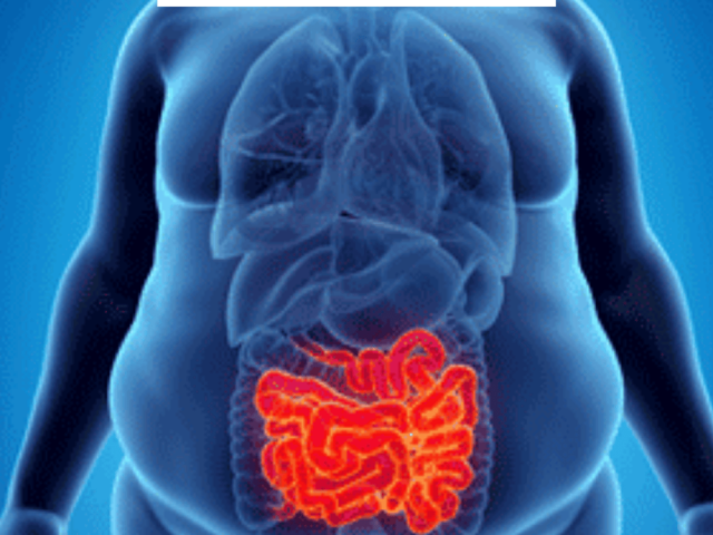 advanced-weight-loss-care-by-the-best-obesity-surgeon-in-mumbai