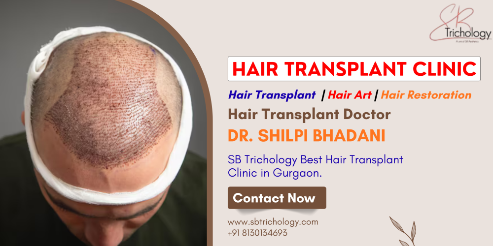 hair-transplant-clinic-in-gurgaon-natural-density-big-0