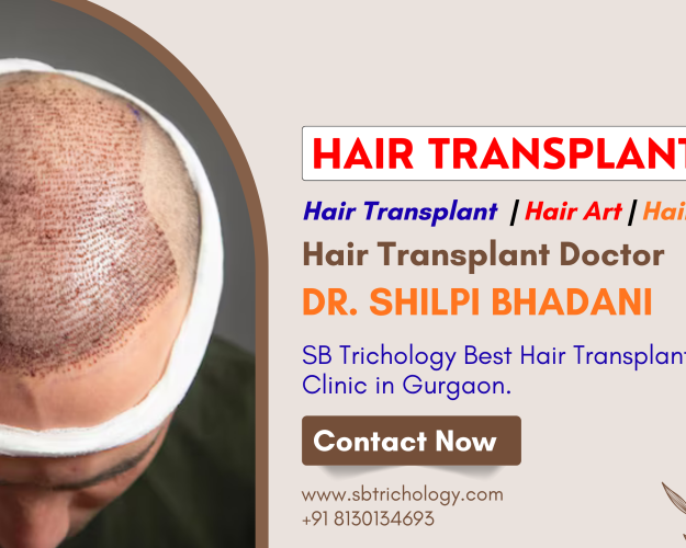 hair-transplant-clinic-in-gurgaon-natural-density