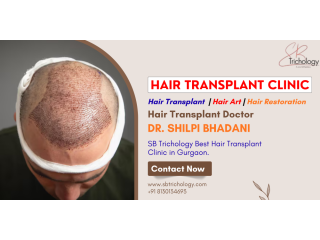 hair-transplant-clinic-in-gurgaon-natural-density-small-0