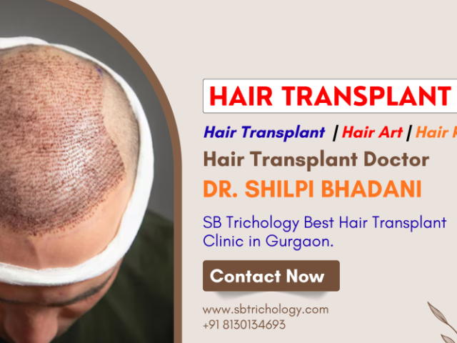 hair-transplant-clinic-in-gurgaon-natural-density