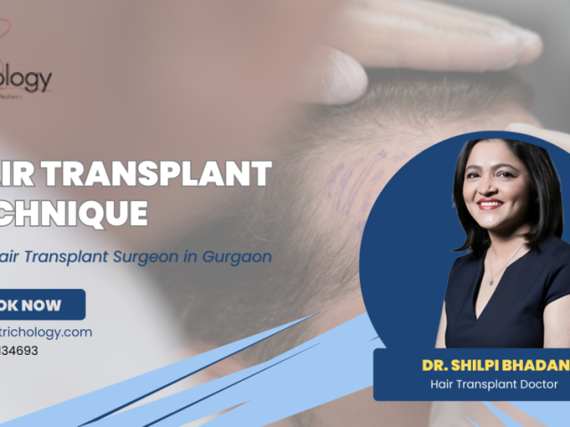 hair-transplant-clinic-in-gurgaon-best-hair-transplant-technique