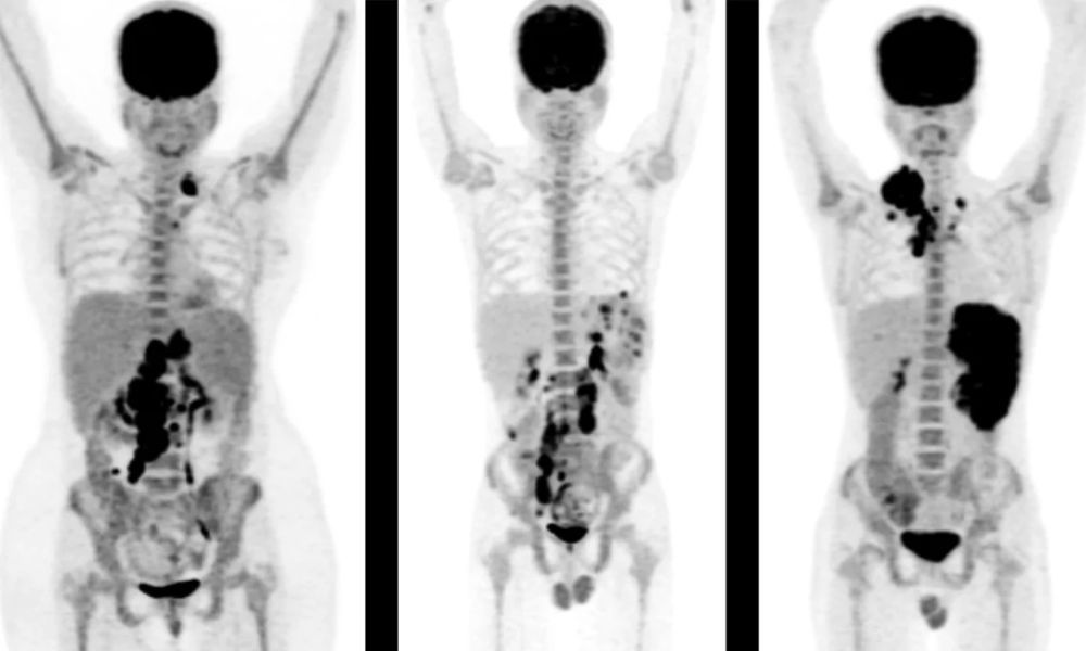 diagnostic-pet-ct-scan-in-mumbai-picture-this-big-0