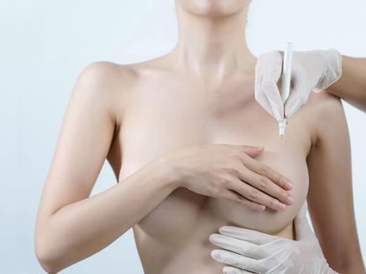 is-breast-reconstruction-surgery-worth-it-benefits-outcomes