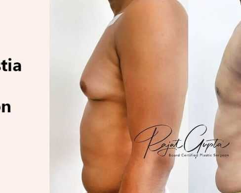 gynecomastia-surgery-consultation-online-how-to-prepare