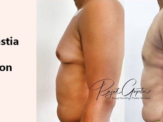 gynecomastia-surgery-consultation-online-how-to-prepare