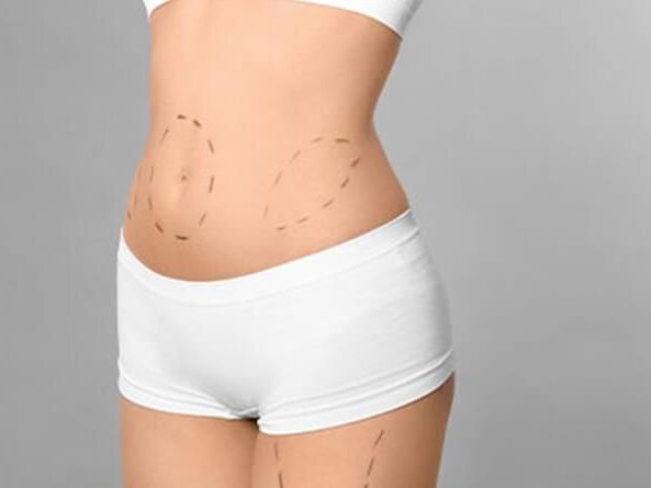 what-body-part-is-most-painful-to-liposuction