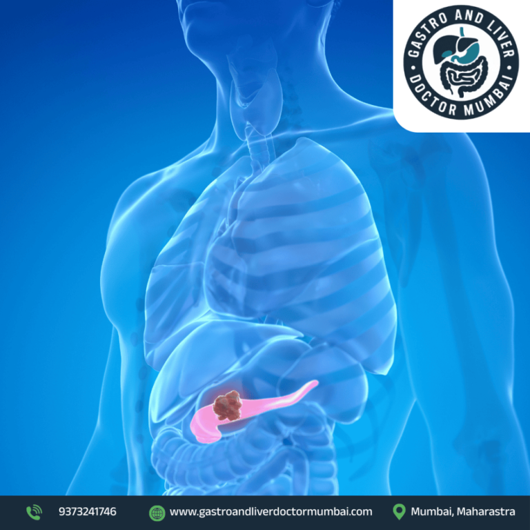 advanced-pancreatic-cancer-treatment-in-mumbai-with-expert-care-big-0