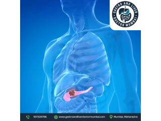 advanced-pancreatic-cancer-treatment-in-mumbai-with-expert-care-small-0