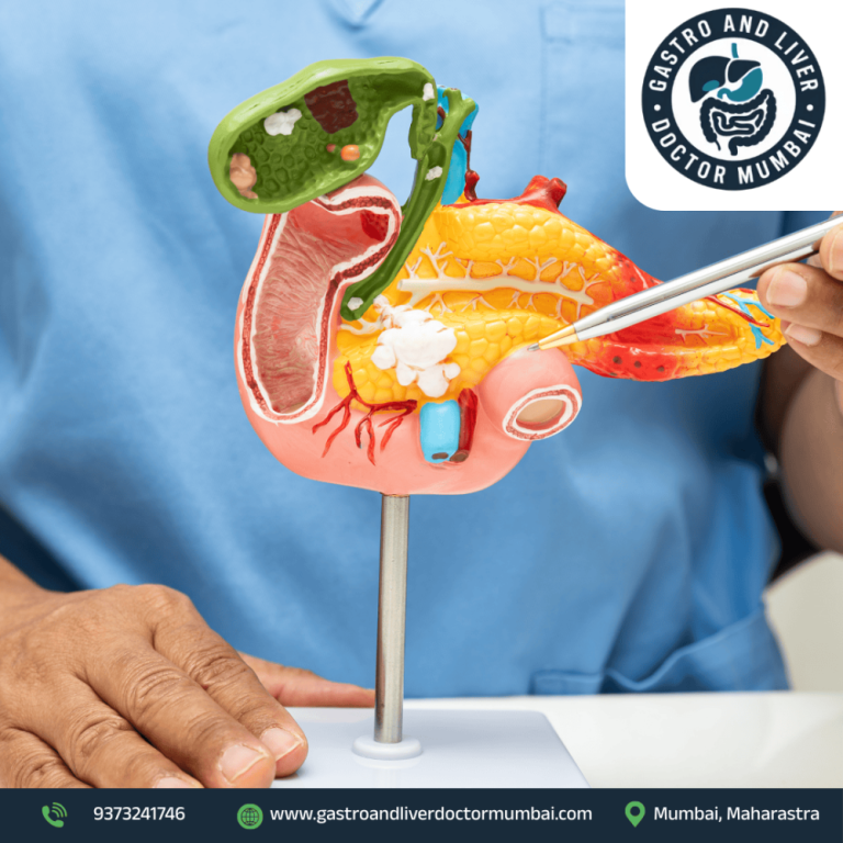 dr-shankar-zanwar-best-gallbladder-cancer-treatment-in-mumbai-big-0