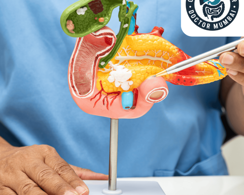 dr-shankar-zanwar-best-gallbladder-cancer-treatment-in-mumbai