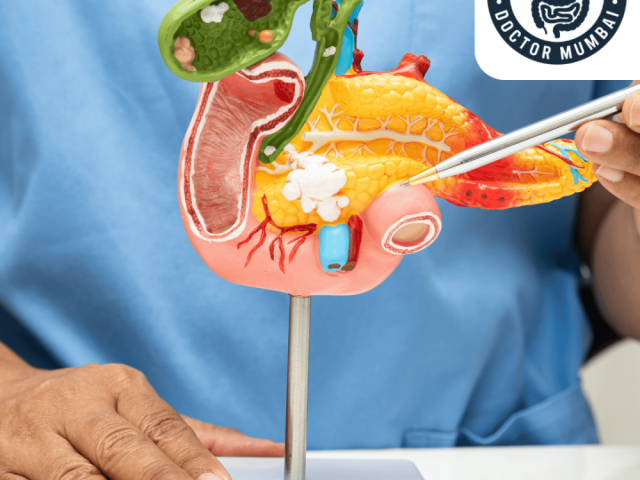 dr-shankar-zanwar-best-gallbladder-cancer-treatment-in-mumbai