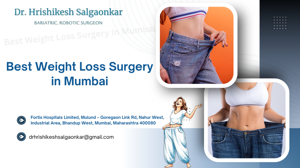 structured-surgical-solutions-for-weight-reduction-big-0