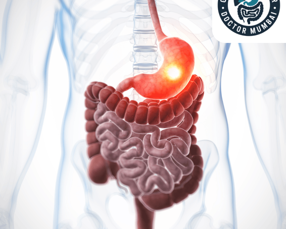 get-the-best-stomach-cancer-treatment-in-mumbai-dr-shankar-zanwar