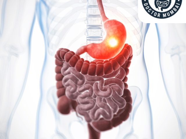 get-the-best-stomach-cancer-treatment-in-mumbai-dr-shankar-zanwar