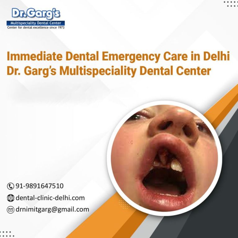 immediate-dental-emergency-care-in-delhi-big-0