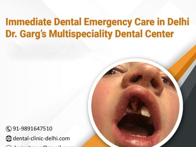 immediate-dental-emergency-care-in-delhi