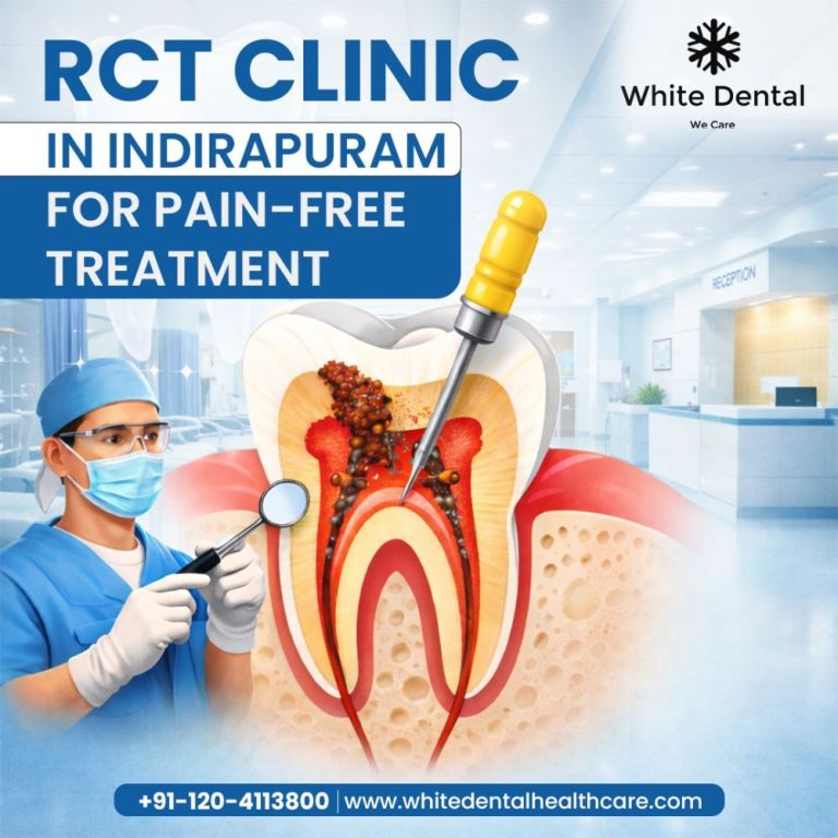 rct-clinic-in-indirapuram-for-pain-free-treatment-big-0