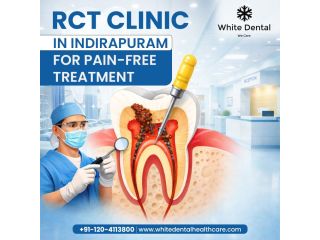 rct-clinic-in-indirapuram-for-pain-free-treatment-small-0